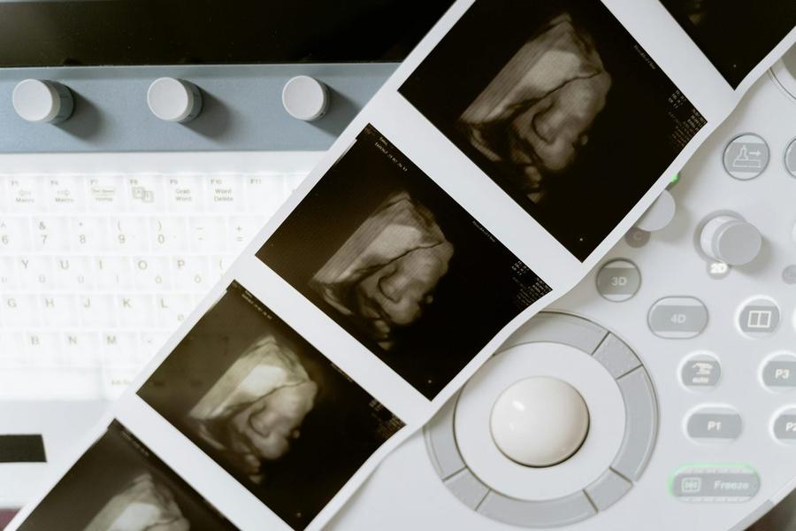 P.M.A: tutto ciò che c'è da sapere sulla procreazione medicalmente assistita